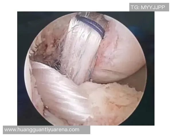 小卡34岁迎生涯首个50分表现ACL部分撕裂与半月板损伤影响膝盖健康 小卡34岁迎生涯首个50分表现ACL部分撕裂与半月板损伤影响膝盖健康